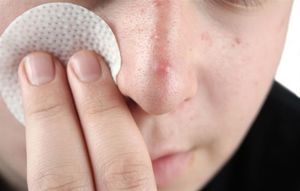 Шишка на лице под кожей лечение народными средствами thumbnail