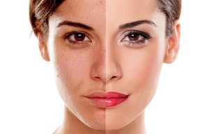 Какими средствами улучшить состояние кожи лица