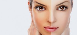 Косметологические процедуры для отбеливания кожи